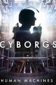 Cyborgs: Human Machines