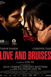 Love and Bruises